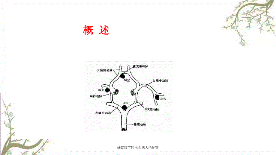 蛛网膜下腔出血病人的护理_第4页