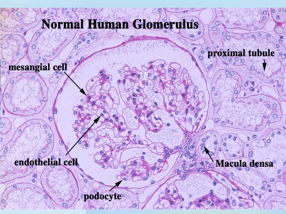 肾内科课件：原发性肾小球疾病概述_第3页