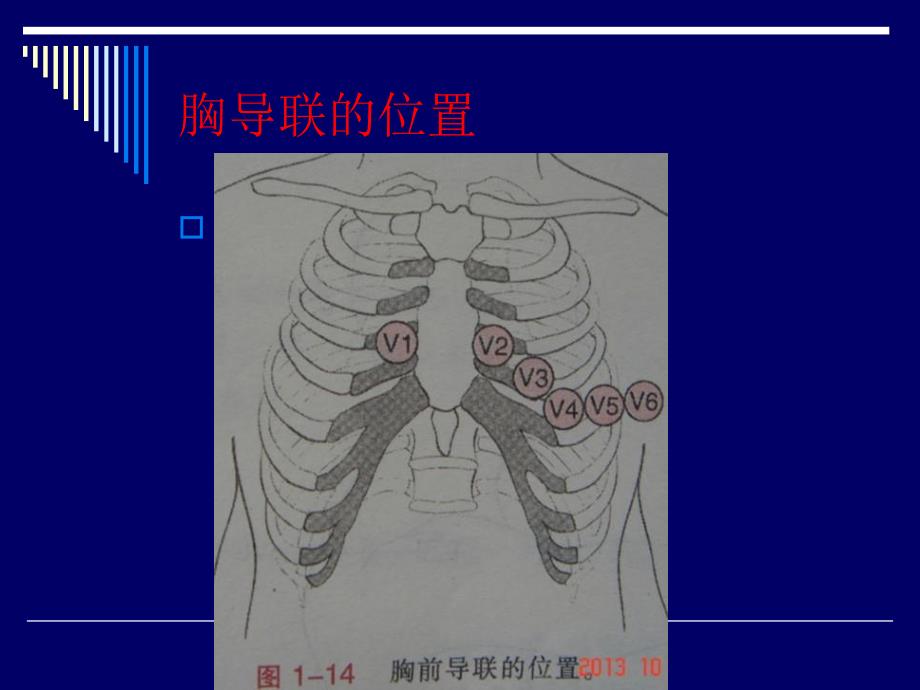 心电图快速解读要点_第2页