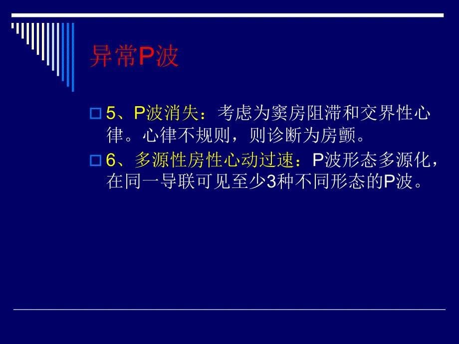 心电图快速解读要点_第5页