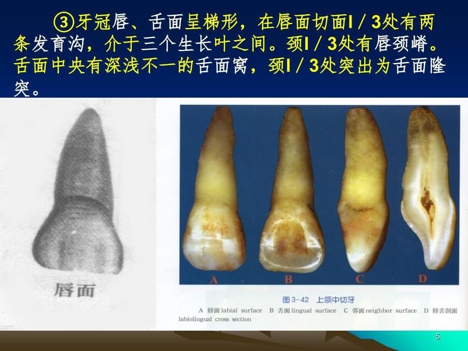 口腔切牙解剖形态PPT精品文档_第5页