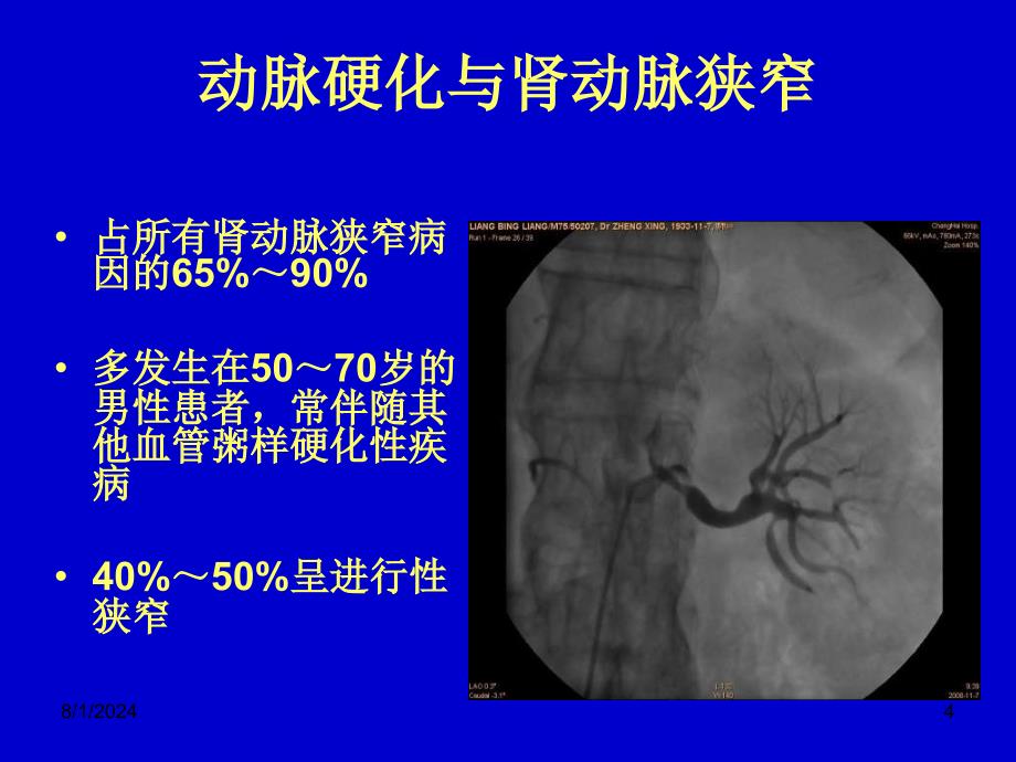 肾血管性高血压的诊断与治疗_第4页