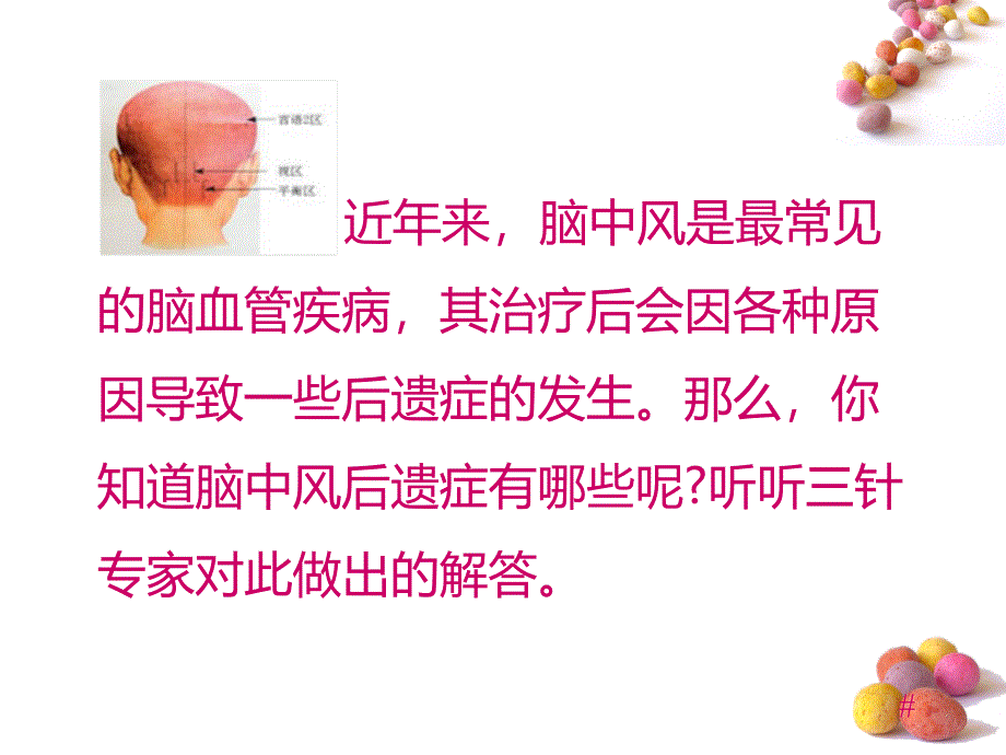 脑中风后遗症的五大症状_第2页