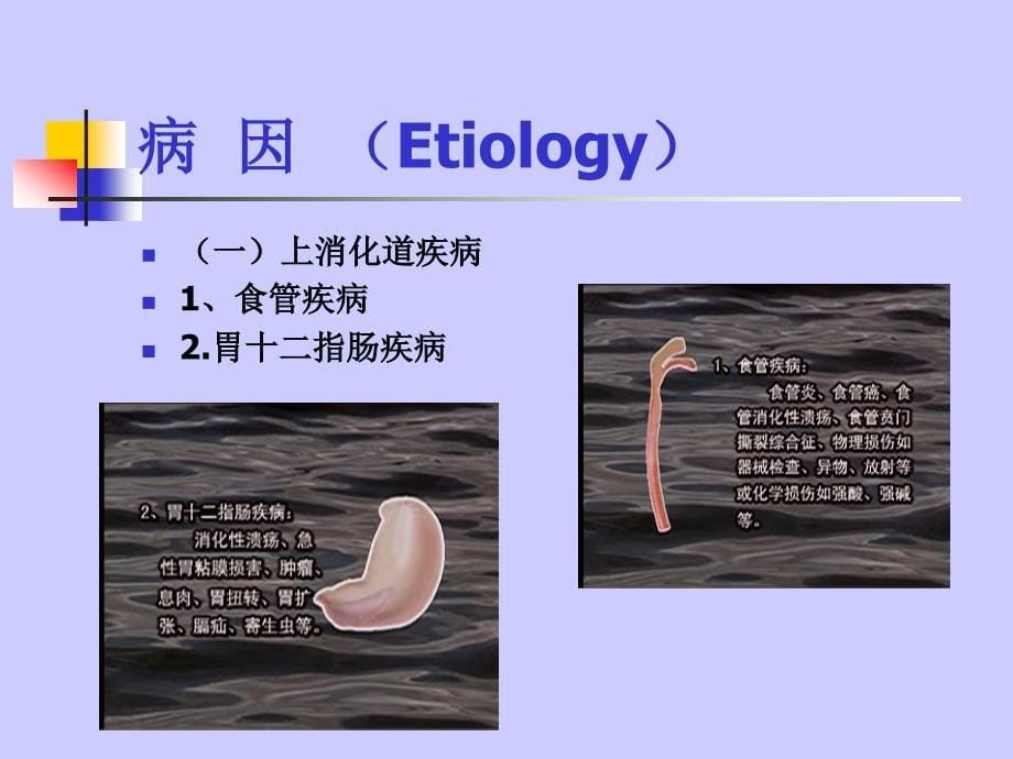 上消化道大出血的护理_第5页