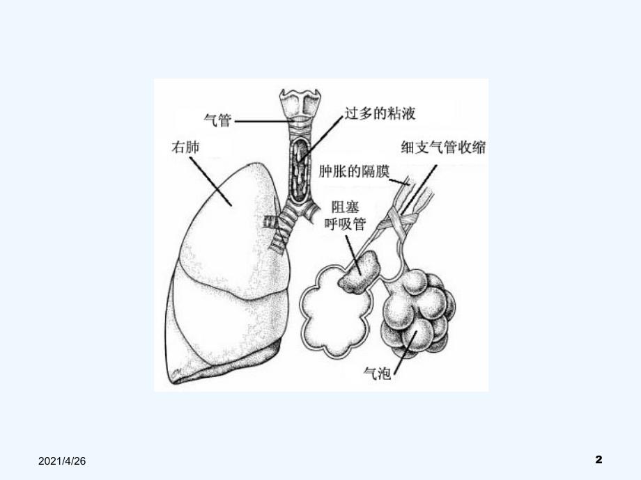 围术期支气管痉挛的防治_第2页