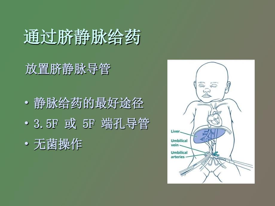 生儿窒息复苏第_第4页