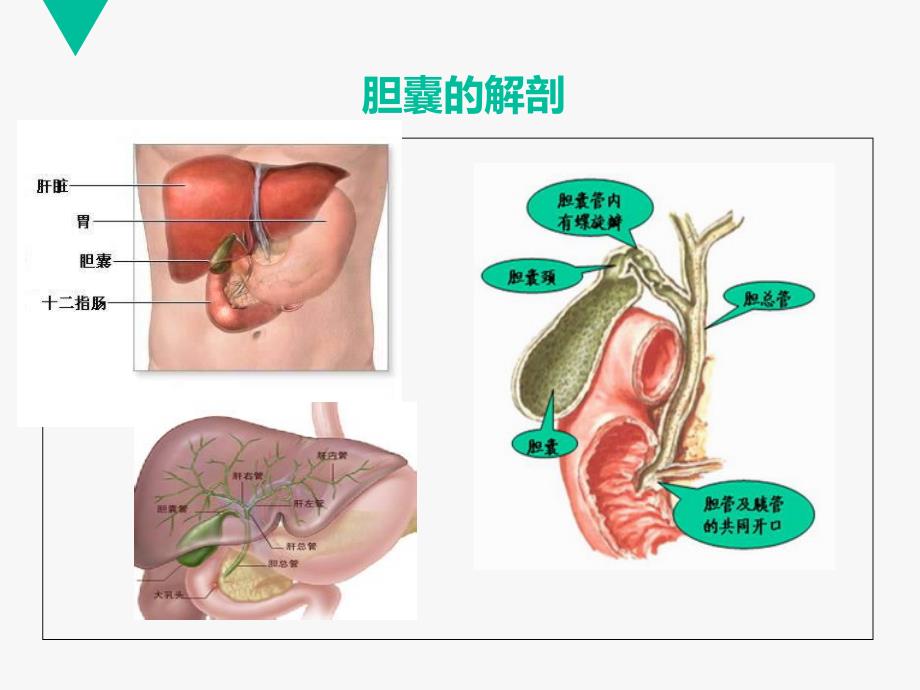 腹腔镜胆囊切除术患者的教学查房课件_第4页