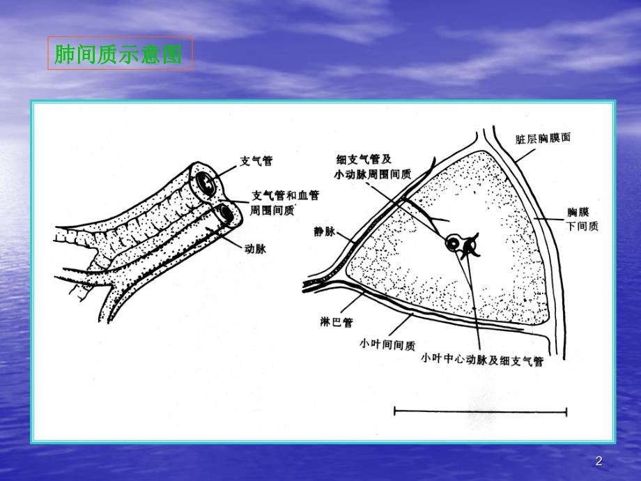 肺间质疾病ppt课件_第2页