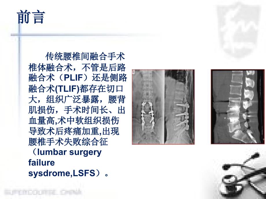 （优质课件）经皮腰椎融合术_第3页