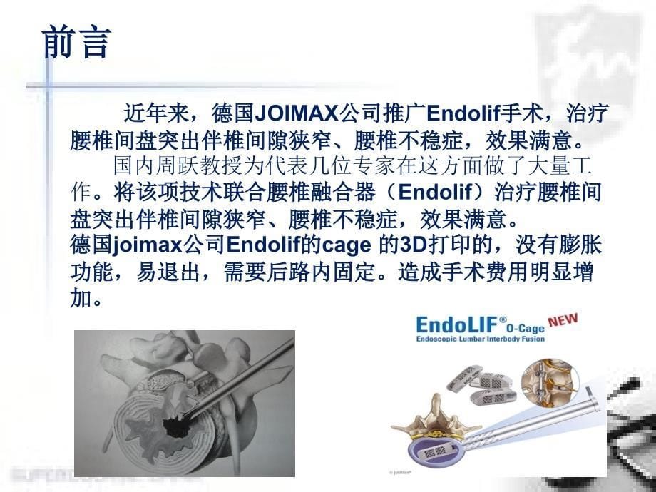 （优质课件）经皮腰椎融合术_第5页