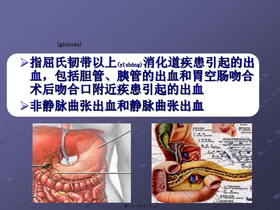 上消化道出血的诊治基础和进展课件_第2页