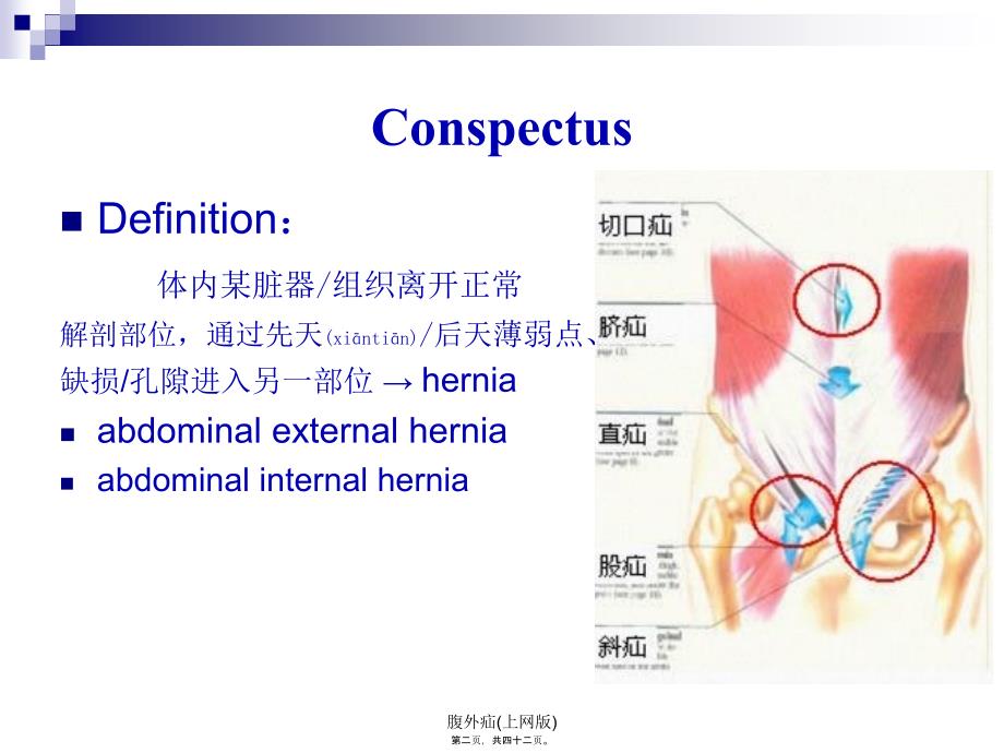 腹外疝上网版课件_第2页