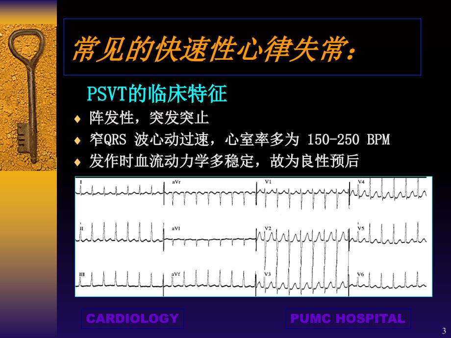 快速性心律失常优秀课件_第3页