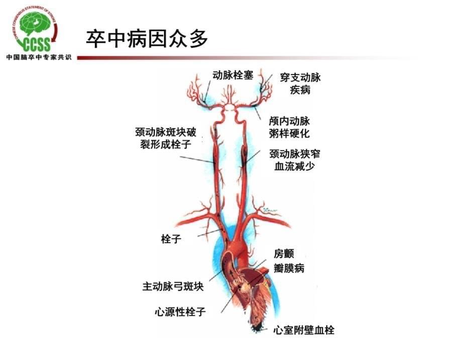 卒中危险因素分层及预防策略课件_第5页