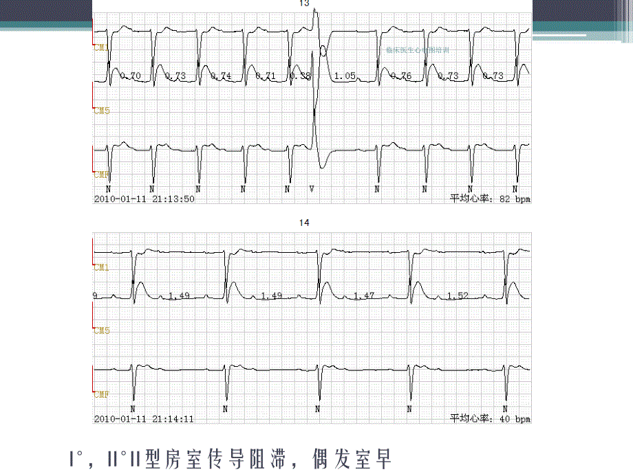 临床医生心电图培训课件_第3页