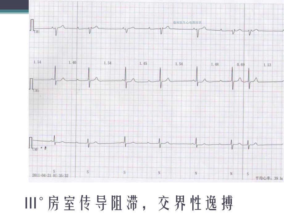 临床医生心电图培训课件_第4页