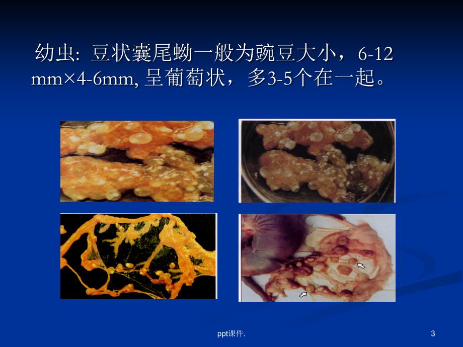 各论绦虫病ppt课件_第3页