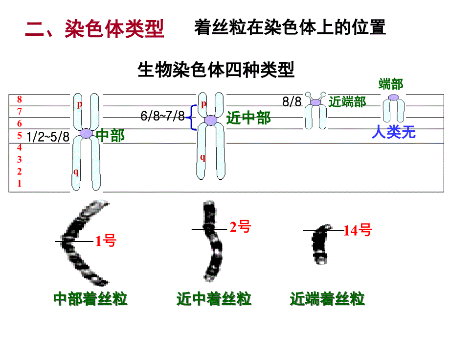 医学遗传学章染色体病1_第4页