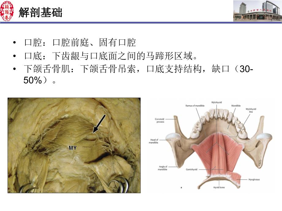 舌口底影像解剖及常见疾病诊断 PPT课件.ppt_第2页