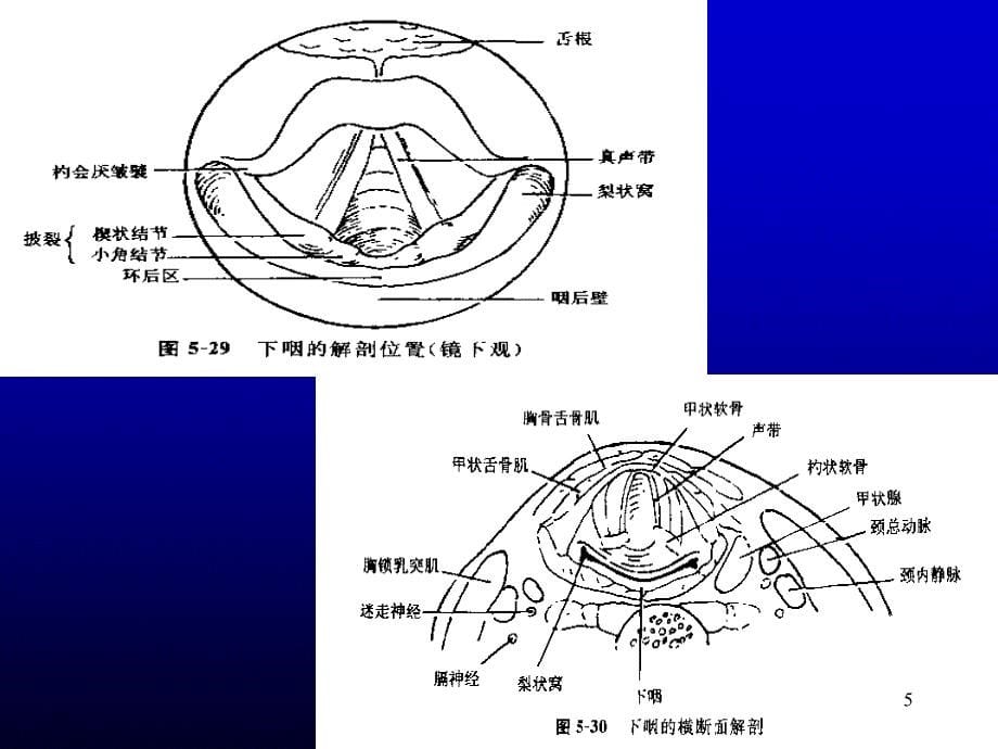 下咽癌介入影像治疗_第5页