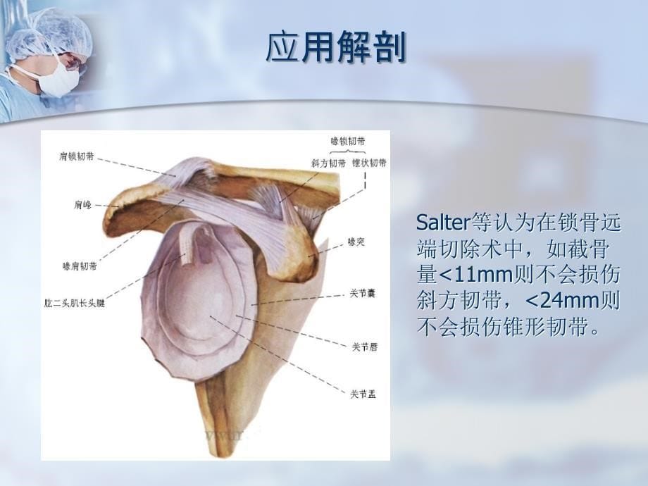 肩锁关节脱位ppt.ppt_第5页