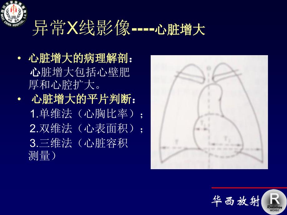 循环系统影22_第3页