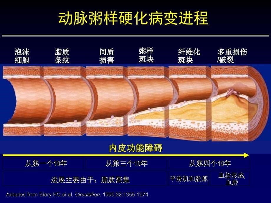 冠心病早期诊断策略_第5页