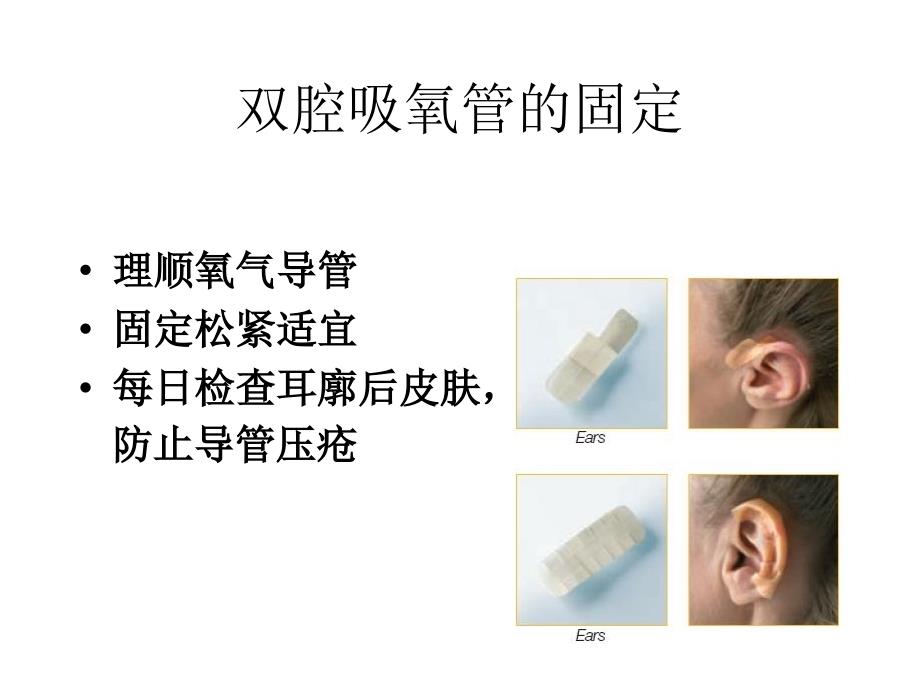 各种导管固定PPT课件_第3页