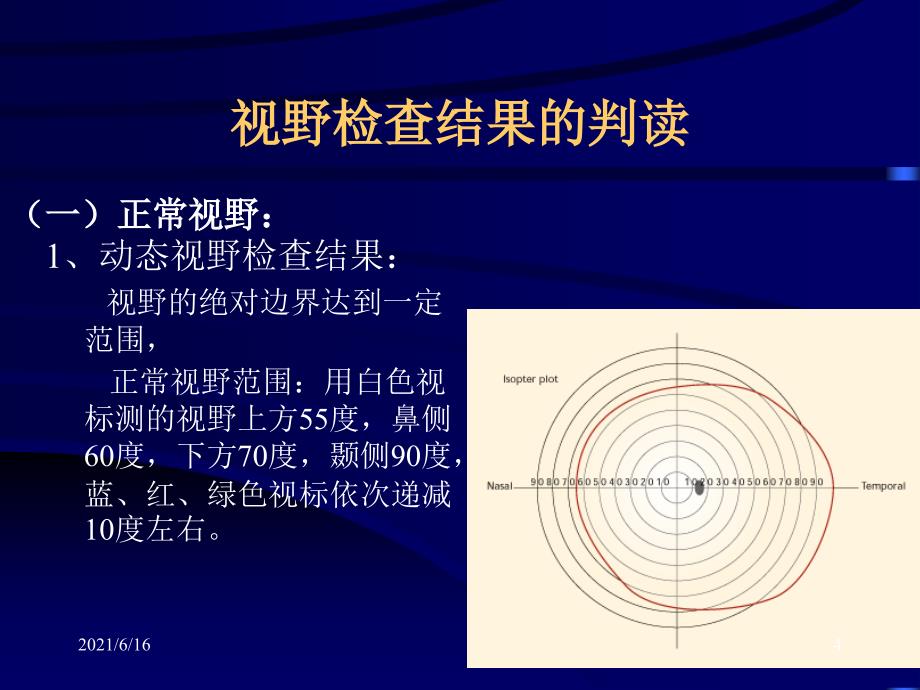 视野缺损PPT课件_第4页