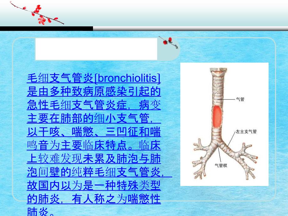 毛细支气管炎的护理查房ppt课件_第2页