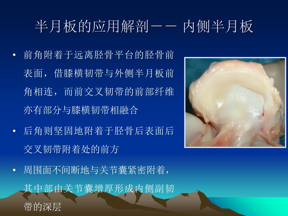 半月板解剖与MR诊断_第4页