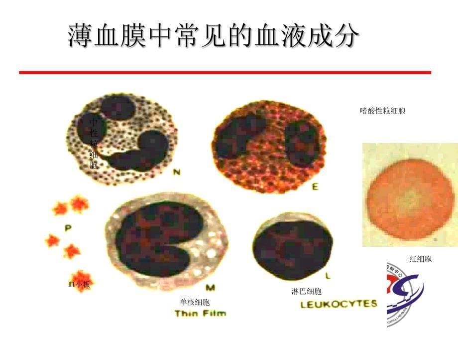 疟原虫的镜下形态_第5页