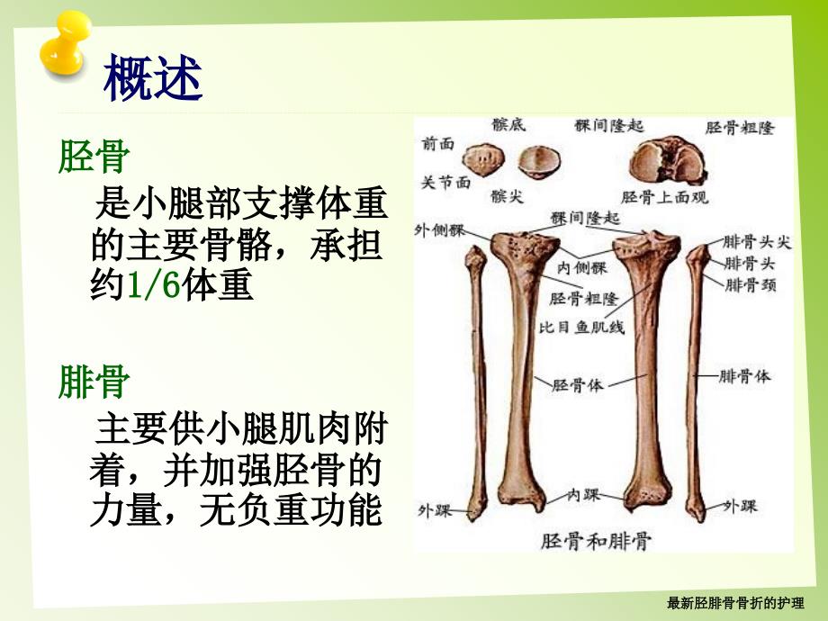 最新胫腓骨骨折的护理_第3页