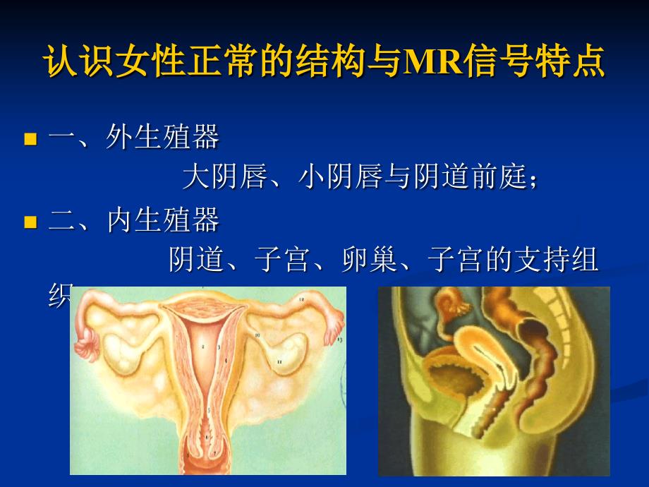 最新MRI在妇产科疾诊断的应用课件精选PPT文档_第2页