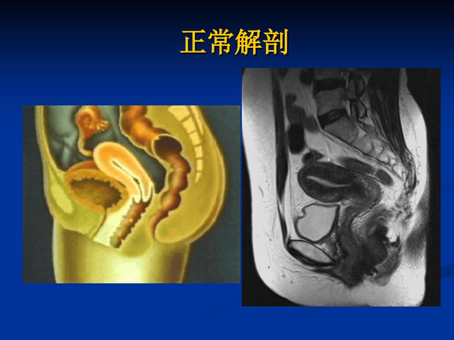 最新MRI在妇产科疾诊断的应用课件精选PPT文档_第3页