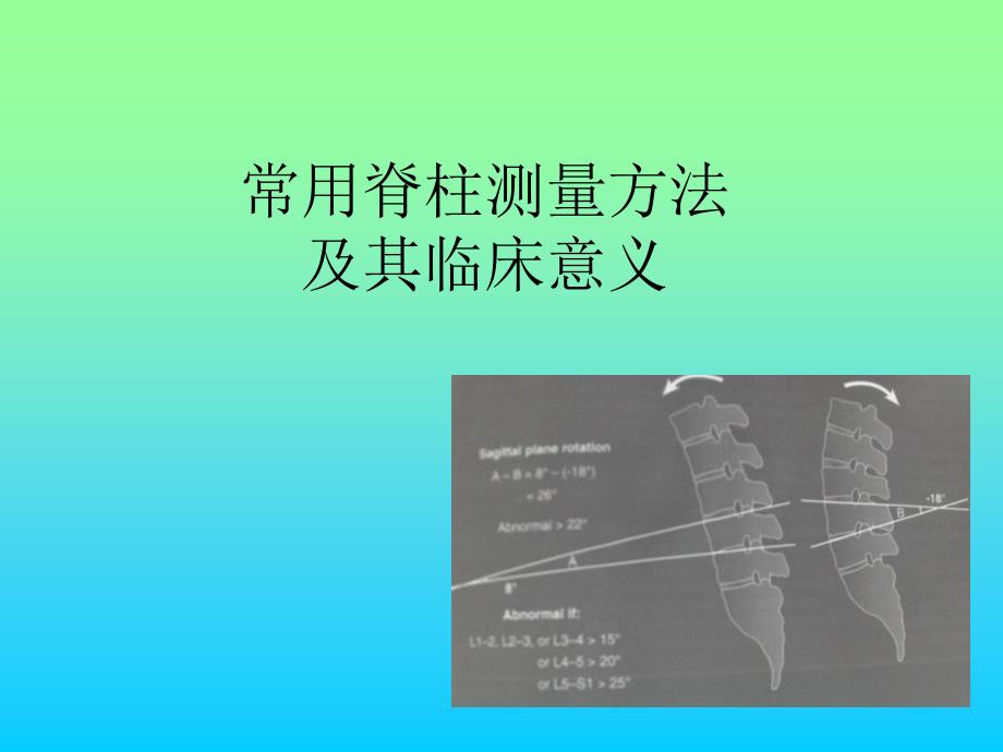 常用脊柱测量方法及其临床意义_第1页