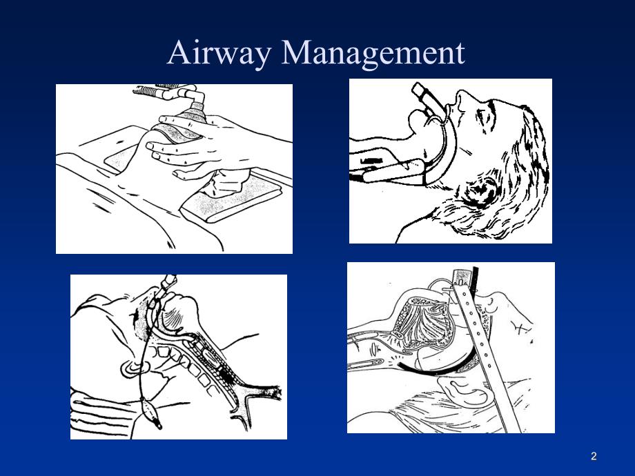 喉罩及其临床应用PPT课件_第2页