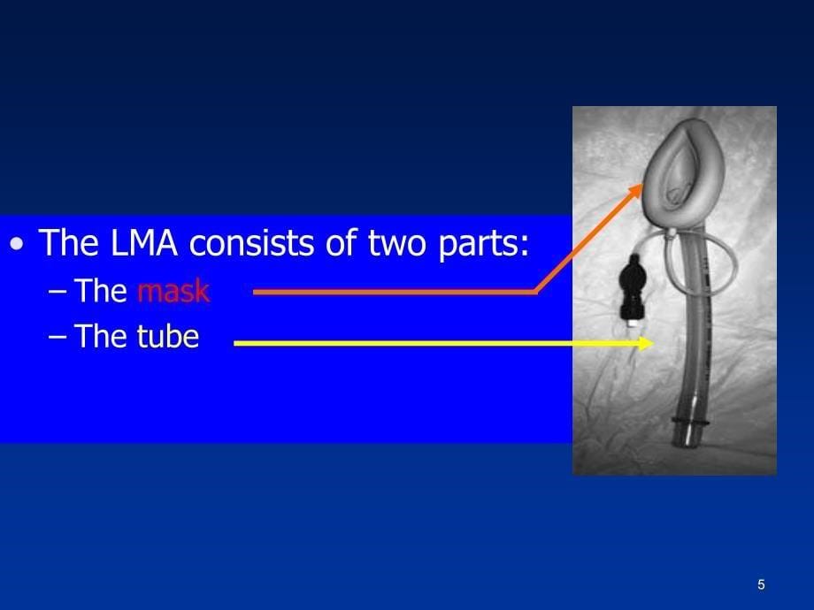 喉罩及其临床应用PPT课件_第5页