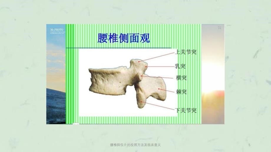 腰椎斜位片的投照方法及临床意义课件_第5页