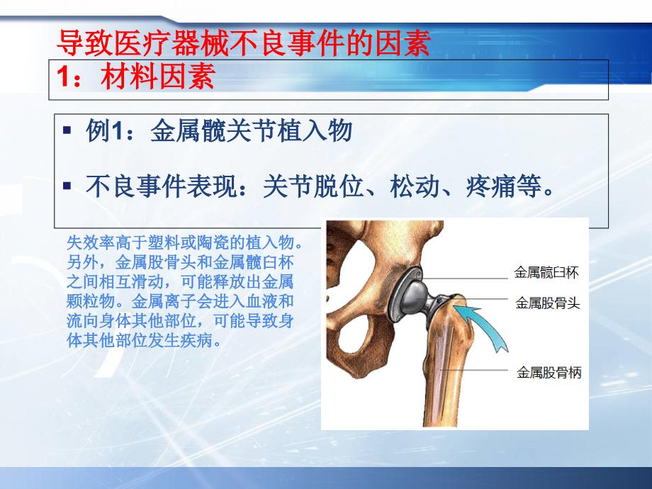 最新医疗器械不良事件_第4页