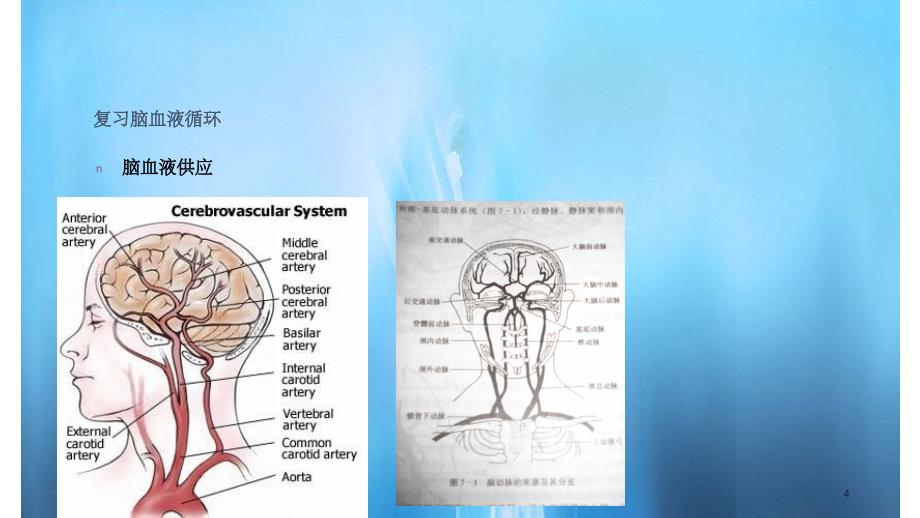 脑血管疾病24PPT课件实用课件_第4页