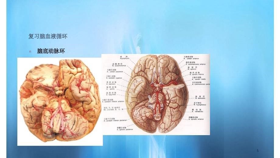 脑血管疾病24PPT课件实用课件_第5页