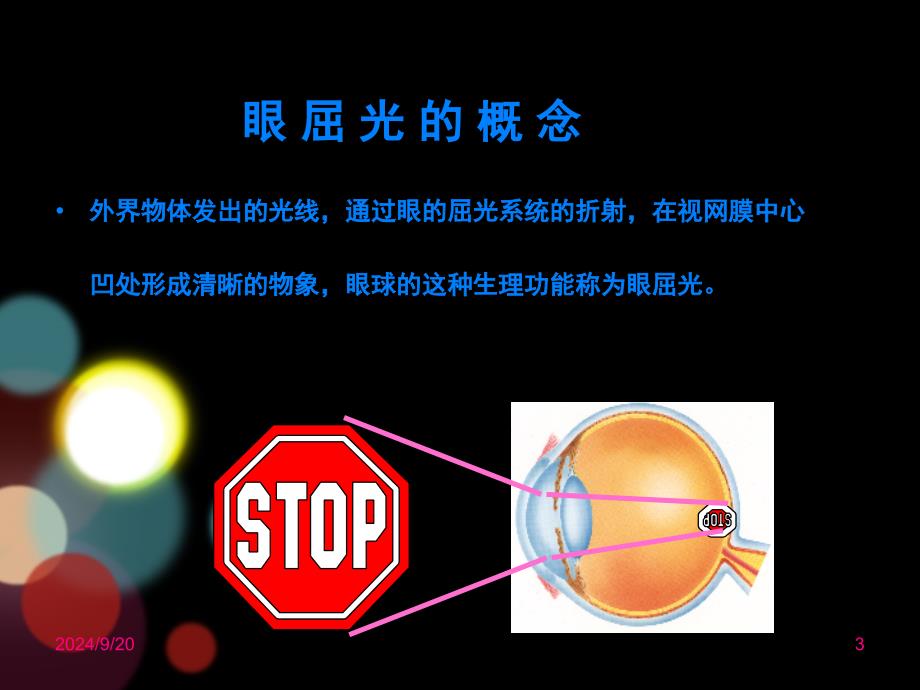 眼视光学课堂PPT_第3页