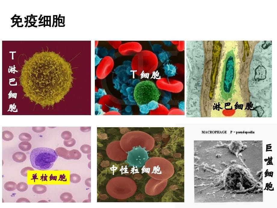 高二生物《免疫调节》课件_第5页