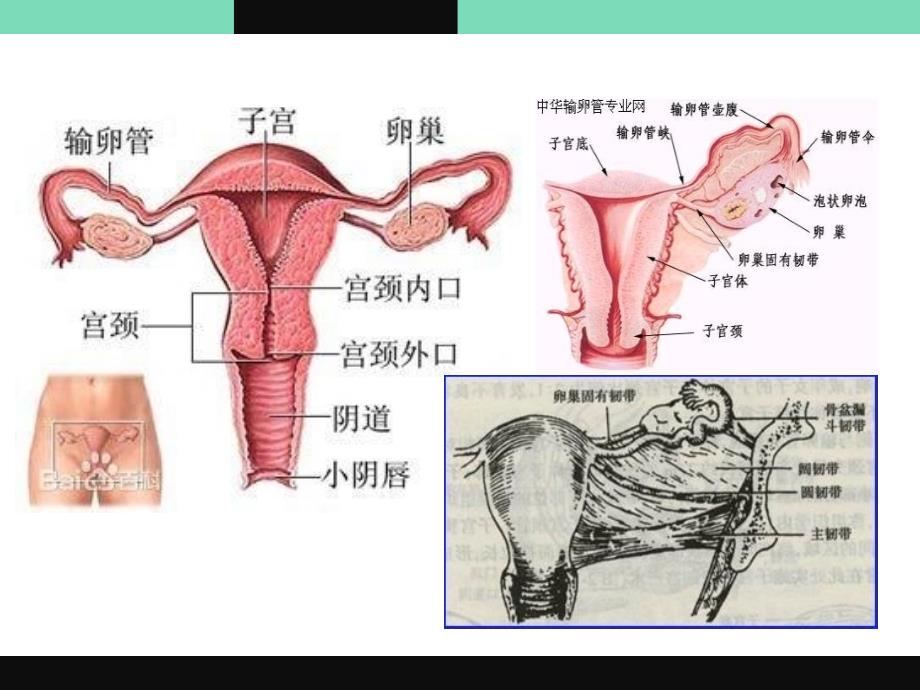 经腹子宫肌瘤剔除术课件_第4页