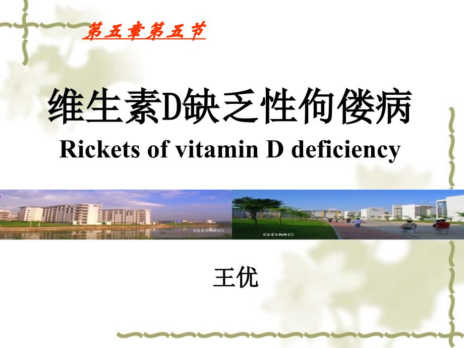 Rickets of VitD Deficiency非临床_第1页