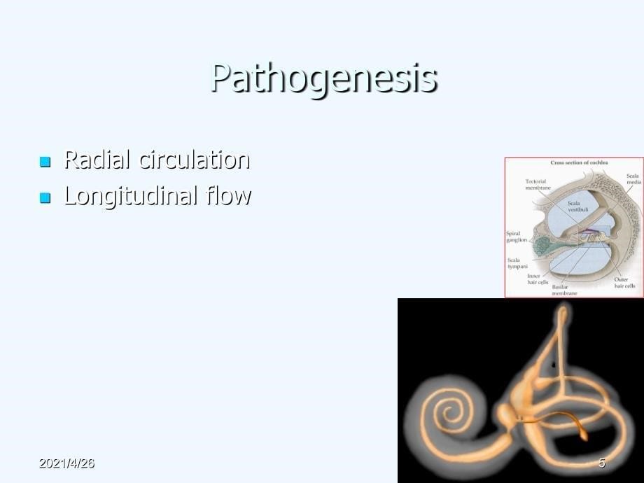 Meniere&#39;s Disease 课件医学课件_第5页