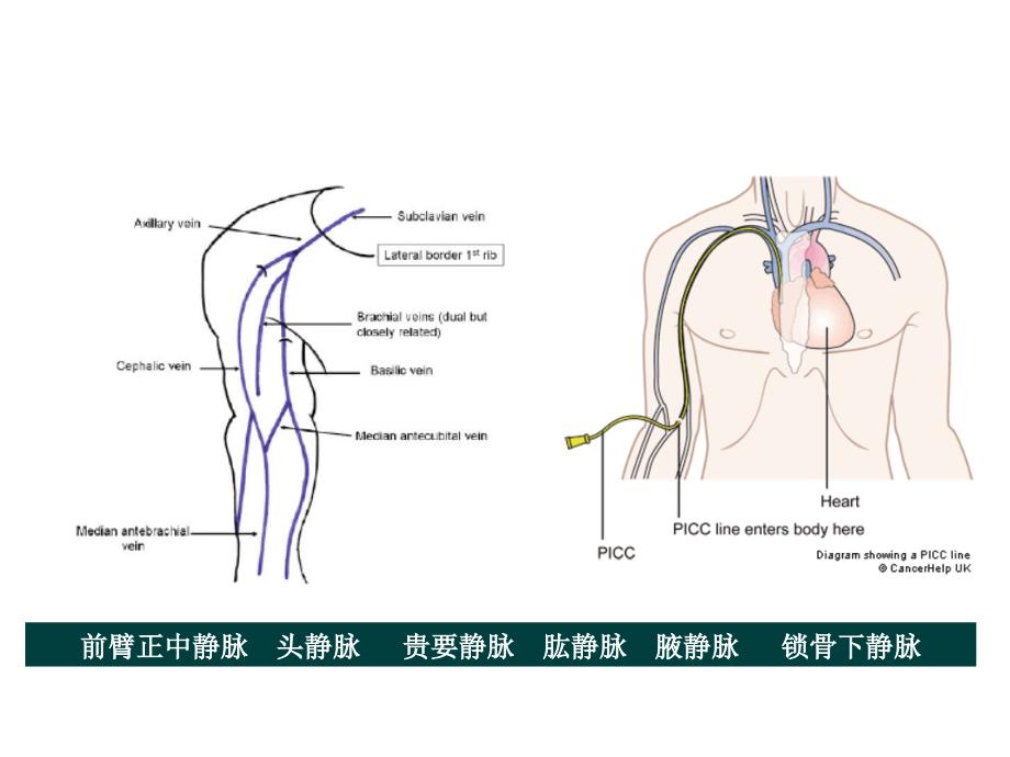 PICC导管头端定位与并发症处理ppt精品医学课件_第4页