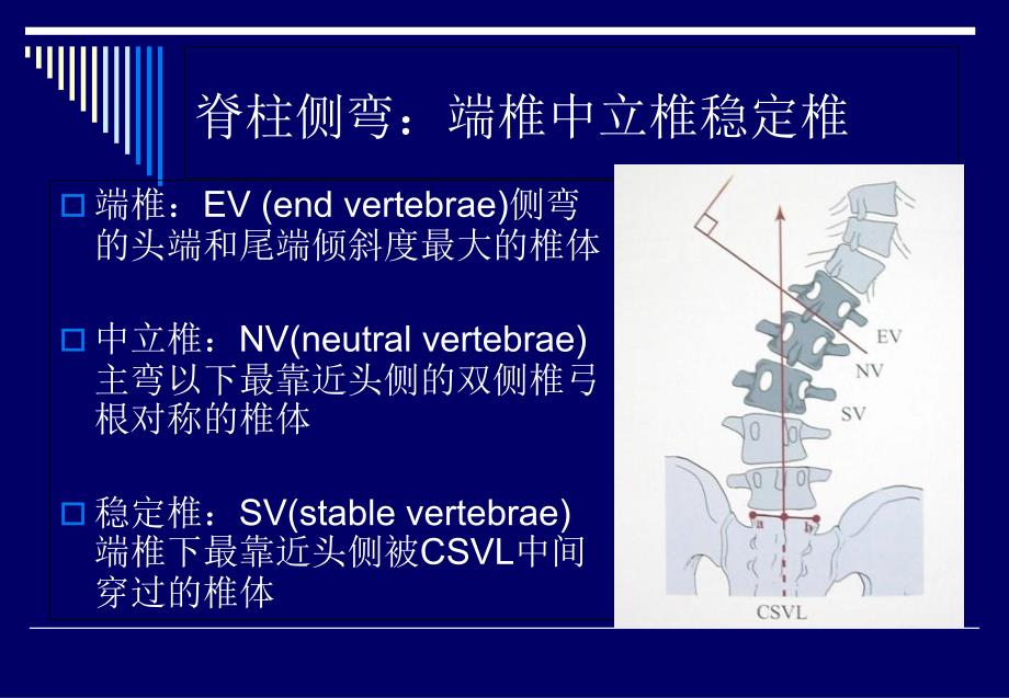 脊柱侧弯基础知识文档资料_第1页