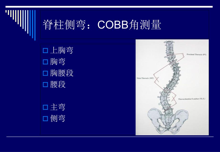 脊柱侧弯基础知识文档资料_第2页